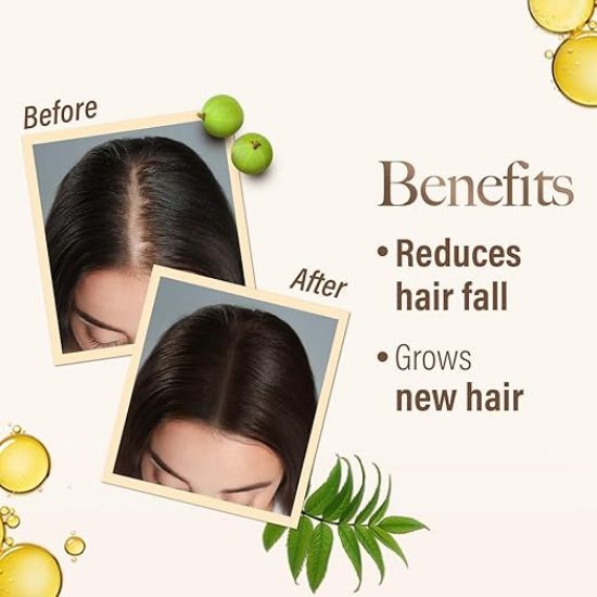 కేష్ కింగ్ ఆయుర్వేదిక్ స్కాల్ప్ అండ్ హెయిర్ ఆయిల్, 100ml యొక్క చిత్రం